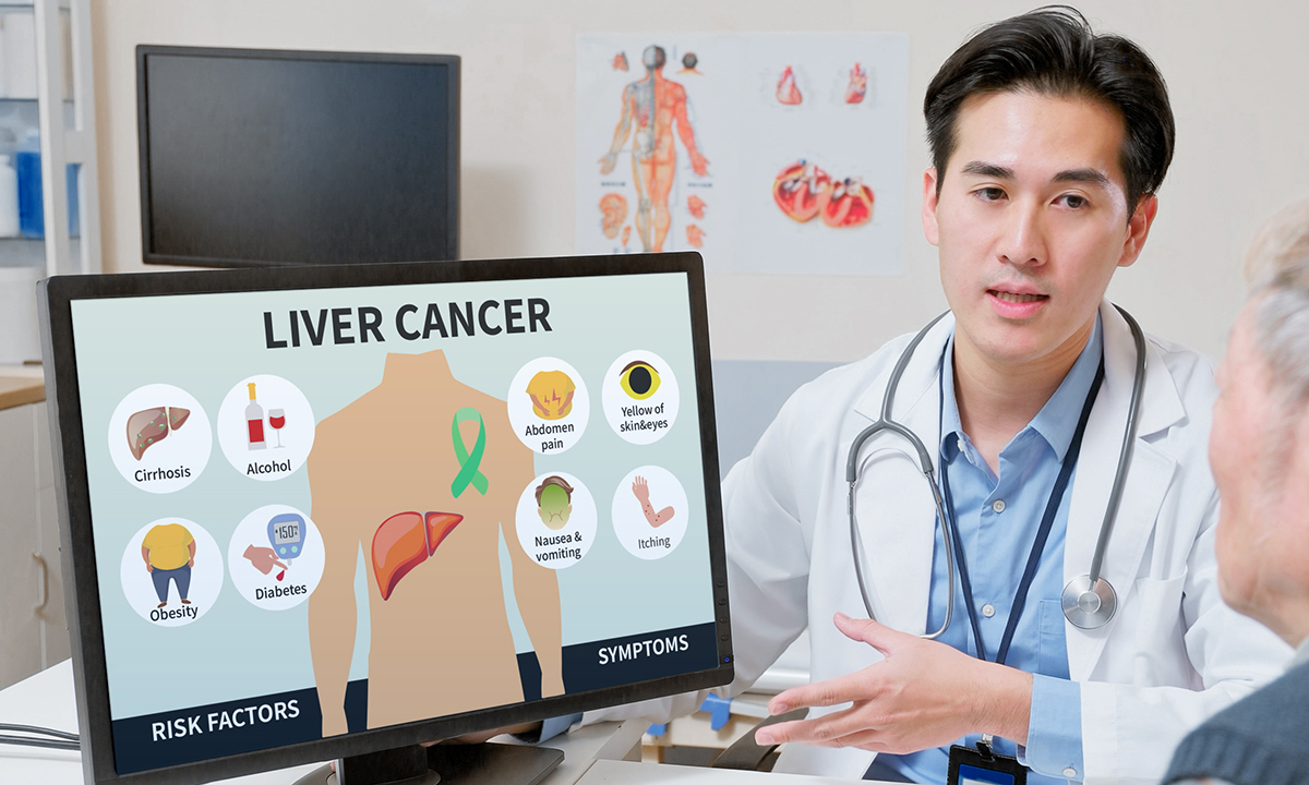 “완치 후에도 절반은 5년 내 재발”… 평소 생활습관 중요한 ‘간암’